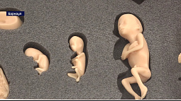 В женские консультации Алтайского края передали специализированные практические пособия