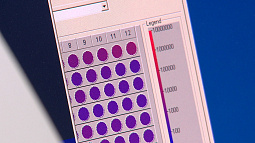 Новорождённых Алтайского края теперь обследуют на 36 генетических заболеваний