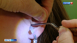 Алтайские врачи фиксируют рост числа пациентов с синдромом Русалочки