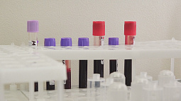 Пройти бесплатное анонимное экспресс-тестирование на ВИЧ с сегодняшнего дня могут жители Барнаула