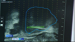 В краевой больнице освоили новую технологию, позволяющую выявить рак простаты на ранних этапах