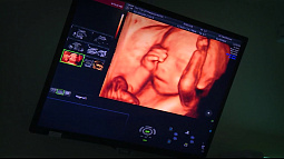 В Алтайском крае более 41 млн руб. направили на поддержку беременных студенток