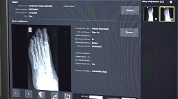 За неделю более 200 барнаульцев получили травмы из-за гололёда