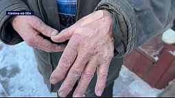 В Камне-на-Оби лиса покусала людей и собак