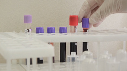 В Барнауле будет работать мобильный комплекс по экспресс-тестированию на ВИЧ-инфекцию 