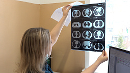 В Алтайском крае на 20% выросло количество детей, заболевших туберкулёзом 