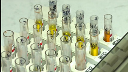 Более тысячи новых случаев ВИЧ-инфекции выявили в Алтайском крае в 2022 году