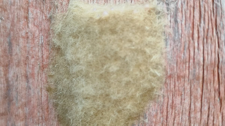 Волдыри, ожоги, зуд и аллергия: жители Чарышского района страдают от нашествия непарного шелкопряда